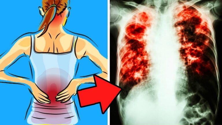Molti ignorano che i primi segnali di polmonite possono salvarci la vita…