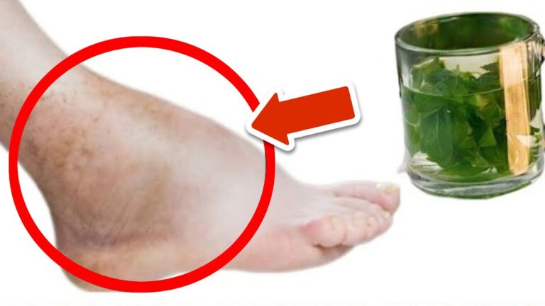 Scopri i 5 tè che eliminano gonfiore da piedi e gambe per sempre!