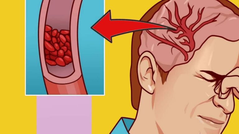 10 Segnali che il tuo corpo ha bisogno di più Magnesium: Scoprili subito!