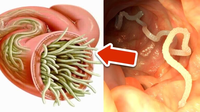 Scopri 7 erbe naturali per eliminare i parassiti dal tuo corpo!