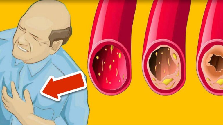 11 alimenti che puliscono le arterie in modo sorprendente! Scopri quali sono!