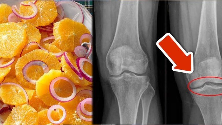 8 modi semplici per rafforzare ginocchia e legamenti in 5 minuti al giorno!