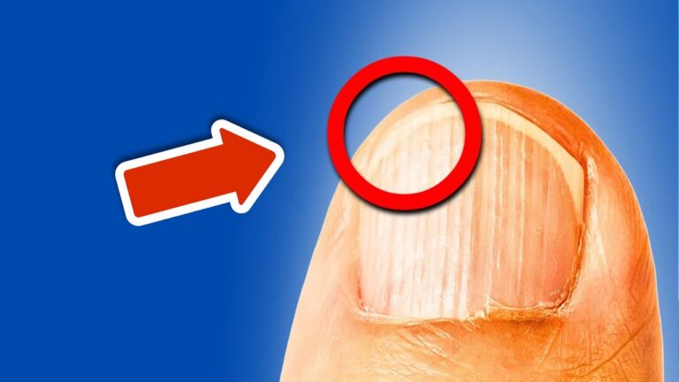 7 segnali che il tuo corpo ha bisogno di nutrienti: scopri quali non ignorare!