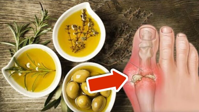 8 modi semplici per eliminare l’acido urico e stare meglio subito!