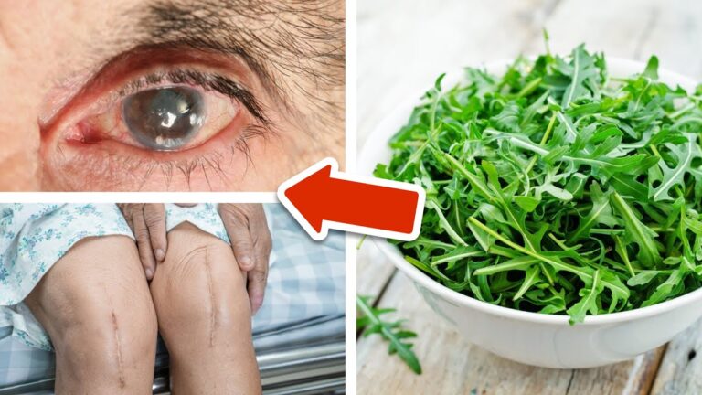 Scopri 5 sorprendenti benefici dell’alimentazione con rucola ogni giorno!