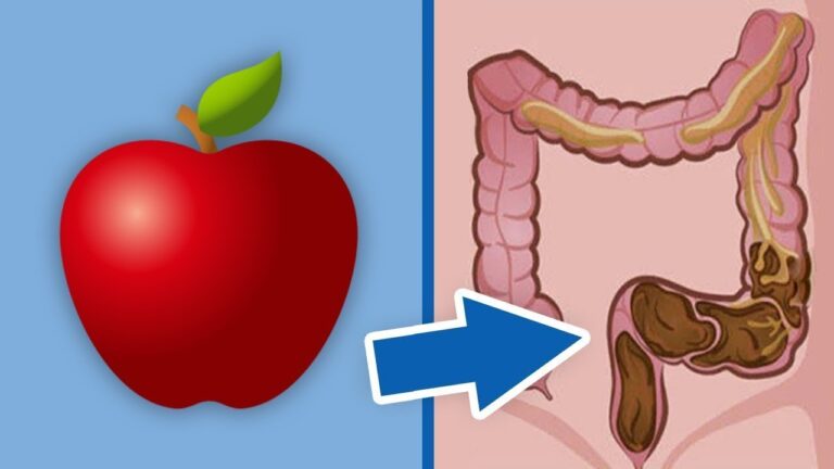 5 rimedi naturali per una pulizia efficace del tuo intestino